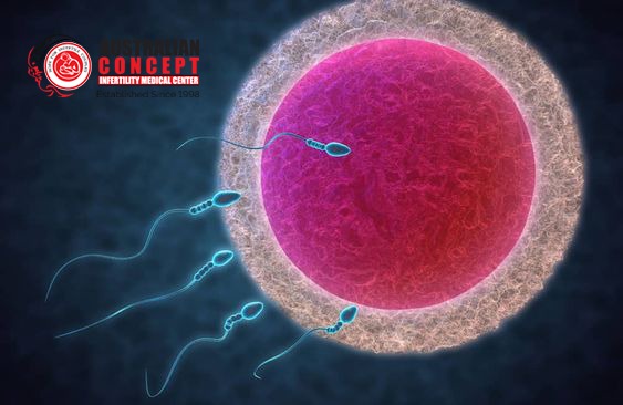 What is ICSI? ICSI Treatment In Lahore Pakistan