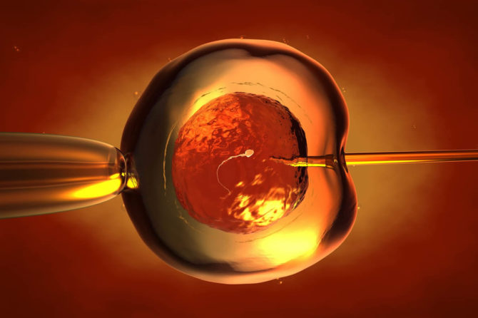 Australian Concept Infertility Medical Center is the Best infertility center.