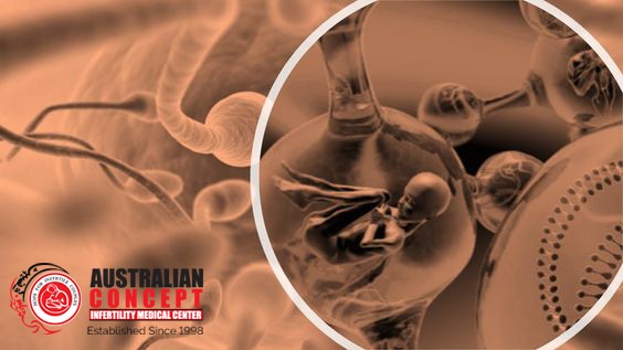 IVF Treatment In Lahore Islamabad Karachi Pakistan