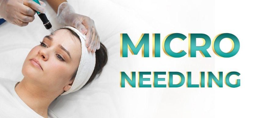 Microneedling Treatment – Microneedling for acne scars – Microneedling benefits