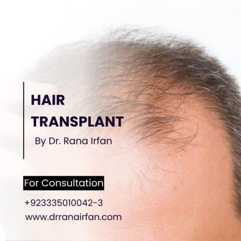 Hair restoration services in islamabad Pakistan
