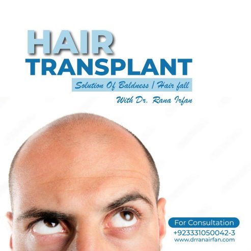 Hair transplant Services by dr rana Irfan