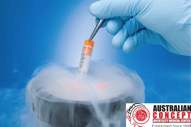 How Best Preimplantation Genetic Screening (PGS)