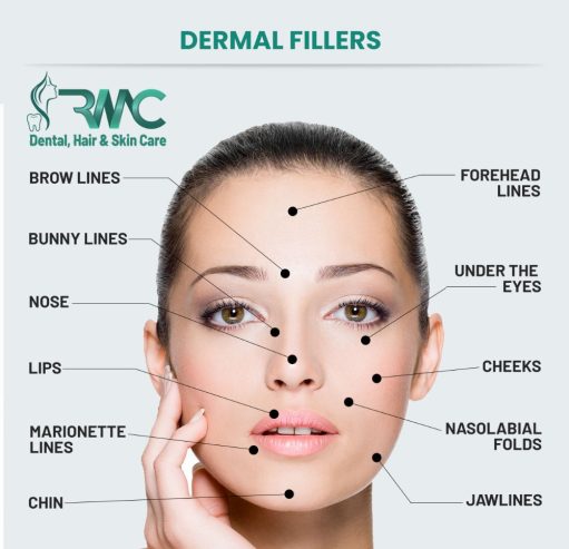 Belotero and Restylane Filler in Islamabad – R M C