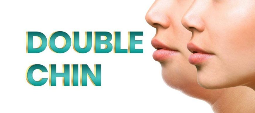 Laser Double Chin Treatment – Double Chin Exercise – Get Rid of Double Chin