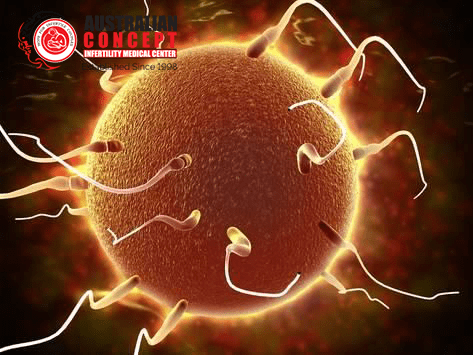 Treatments for Polycystic Ovary Syndrome (PCOS)