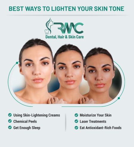 Best Skin Lightening- Whitening Treatment – R M C, Islamabad