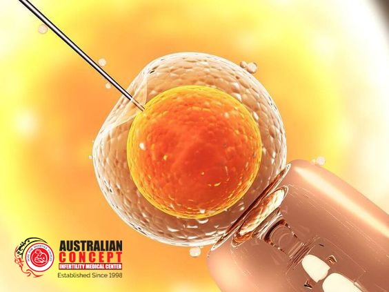 What is IVF? Best IVF Center In Lahore Islamabad Karachi Pakistan
