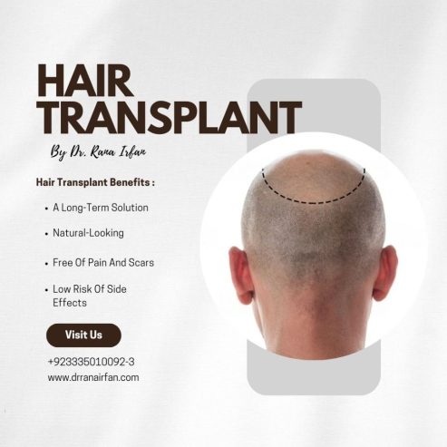 Hair transplant and hair fall treatment in islamabad Pakistan