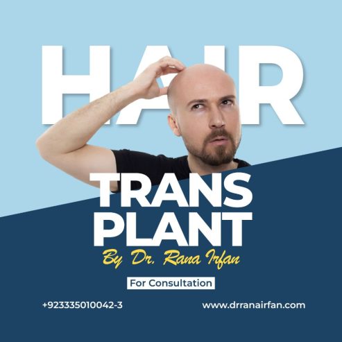 FUT and FUE hair transplant services in Islamabad Pakistan