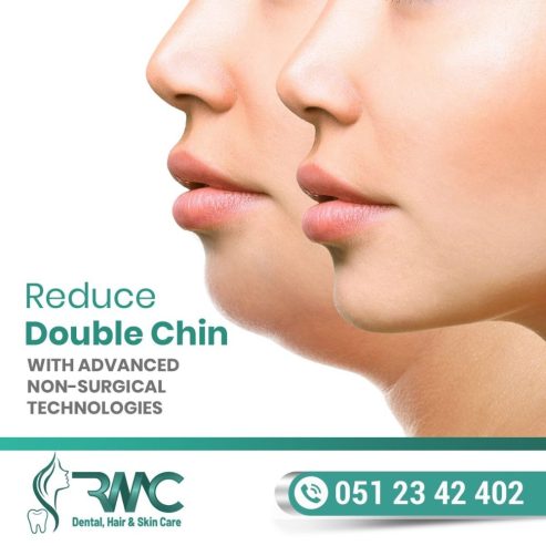 Double Chin Removal in Islamabad
