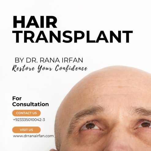 Hair transplant services at vagus Cosmetic Islamabad
